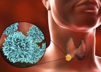 Một ĐẠI DỊCH đang âm thầm lan rộng ở VN ???